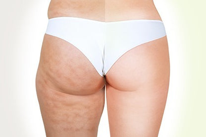 GOMMAGE EFFET ANTI CELLULITE CAFÉINE PACK DE 5